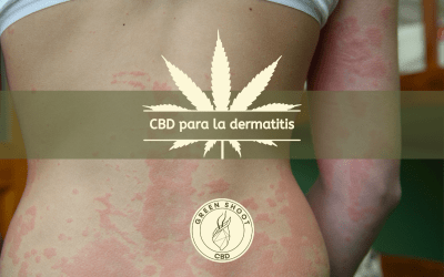 CBD PARA LA DERMATITIS